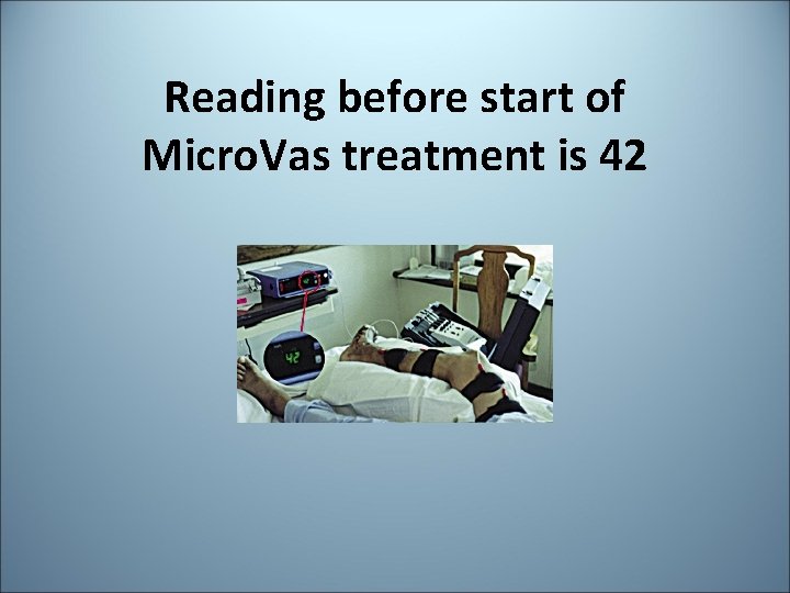 Reading before start of Micro. Vas treatment is 42 Reading before start of Micro. Vas treatment is 42