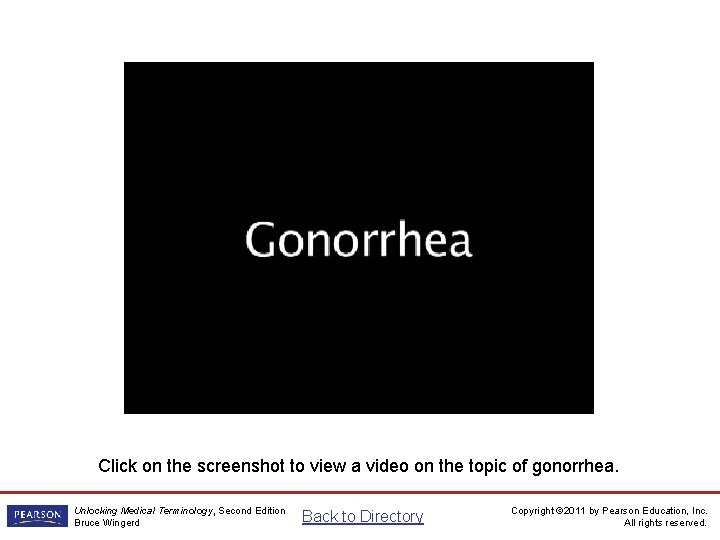 Gonorrhea Video Click on the screenshot to view a video on the topic of