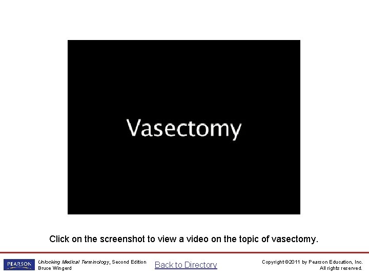 Vasectomy Video Click on the screenshot to view a video on the topic of