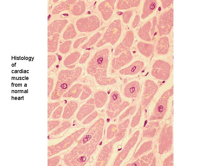 Histology of cardiac muscle from a normal heart 