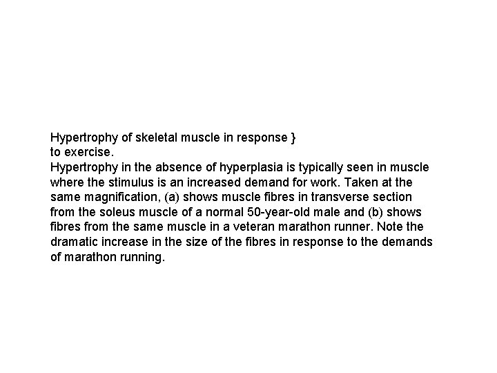 Hypertrophy of skeletal muscle in response } to exercise. Hypertrophy in the absence of