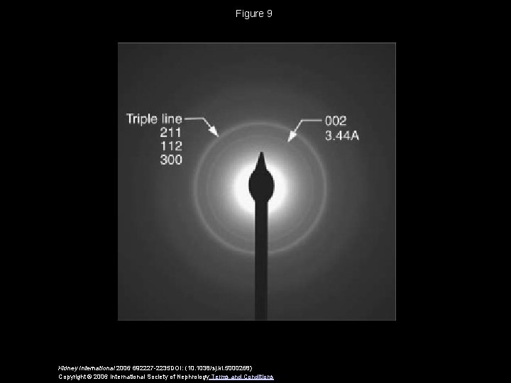 Figure 9 Kidney International 2006 692227 -2235 DOI: (10. 1038/sj. ki. 5000268) Copyright ©