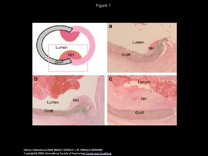 Figure 1 Kidney International 2006 692227 -2235 DOI: (10. 1038/sj. ki. 5000268) Copyright ©