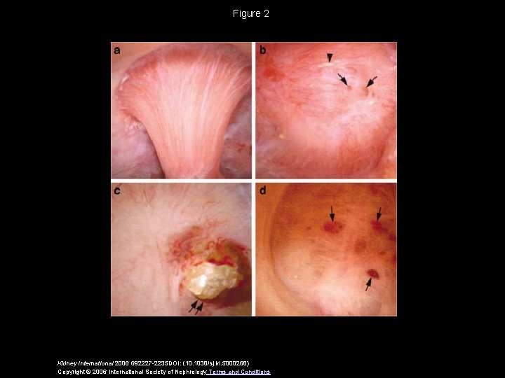 Figure 2 Kidney International 2006 692227 -2235 DOI: (10. 1038/sj. ki. 5000268) Copyright ©