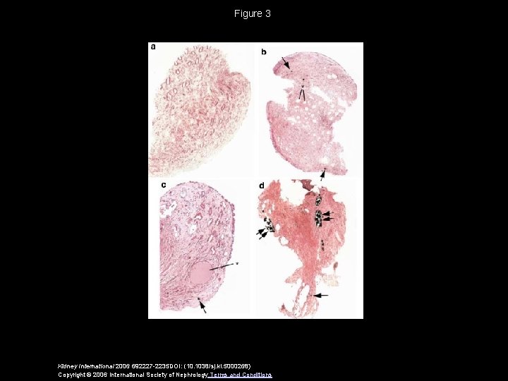 Figure 3 Kidney International 2006 692227 -2235 DOI: (10. 1038/sj. ki. 5000268) Copyright ©