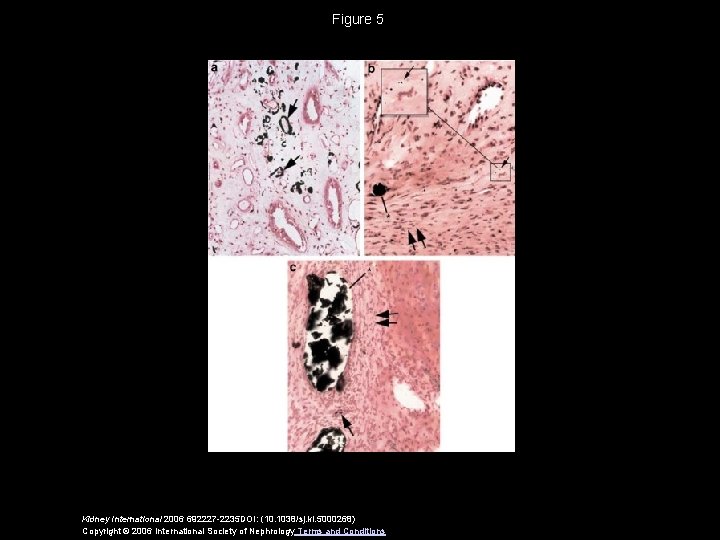 Figure 5 Kidney International 2006 692227 -2235 DOI: (10. 1038/sj. ki. 5000268) Copyright ©