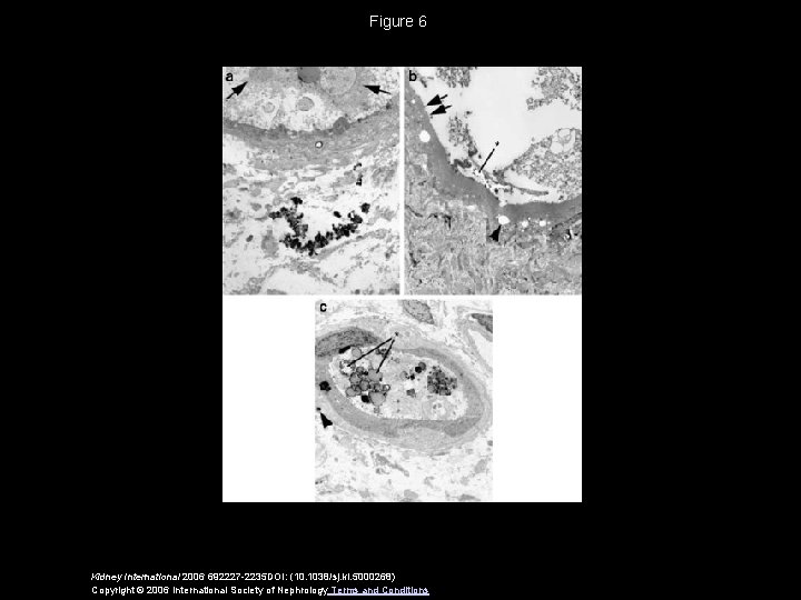 Figure 6 Kidney International 2006 692227 -2235 DOI: (10. 1038/sj. ki. 5000268) Copyright ©