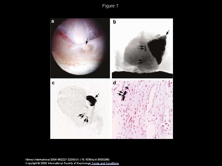 Figure 7 Kidney International 2006 692227 -2235 DOI: (10. 1038/sj. ki. 5000268) Copyright ©