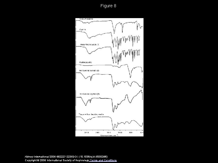 Figure 8 Kidney International 2006 692227 -2235 DOI: (10. 1038/sj. ki. 5000268) Copyright ©