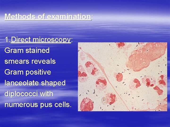 Methods of examination: 1. Direct microscopy: Gram stained smears reveals Gram positive lanceolate shaped Methods of examination: 1. Direct microscopy: Gram stained smears reveals Gram positive lanceolate shaped