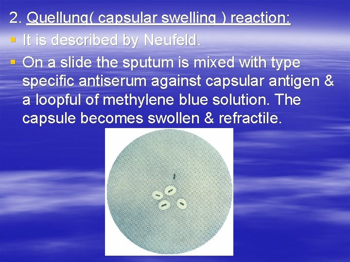 2. Quellung( capsular swelling ) reaction: § It is described by Neufeld. § On 2. Quellung( capsular swelling ) reaction: § It is described by Neufeld. § On
