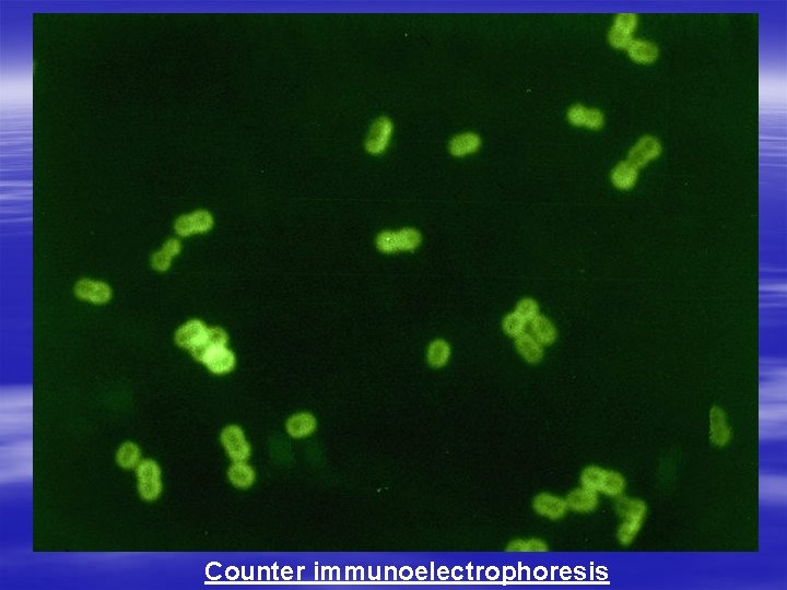 Counter immunoelectrophoresis Counter immunoelectrophoresis