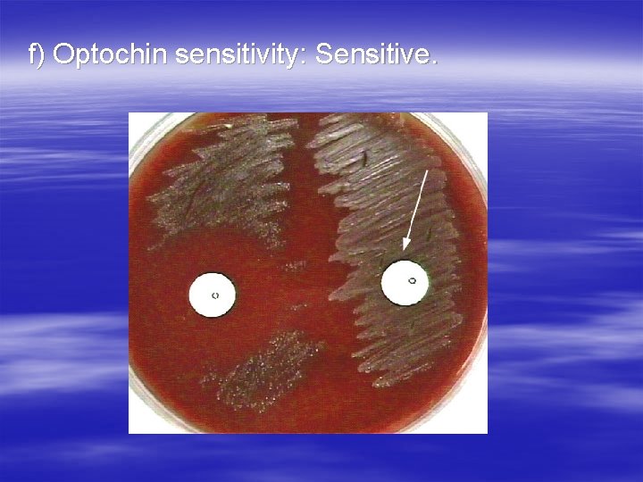 f) Optochin sensitivity: Sensitive. f) Optochin sensitivity: Sensitive.