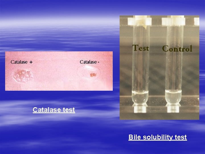 Catalase test Bile solubility test Catalase test Bile solubility test