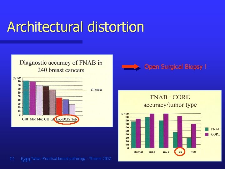 Architectural distortion Open Surgical Biopsy ! (1) From Tabar. Practical breast pathology - Thieme