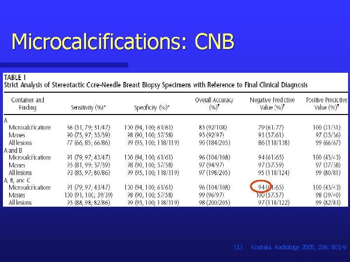 Microcalcifications: CNB (1) Koskela. Radiology 2005; 236: 801 -9 