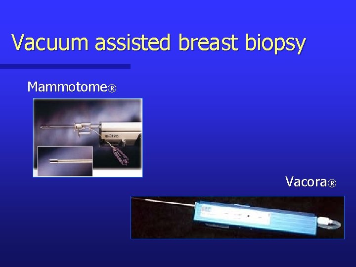 Vacuum assisted breast biopsy Mammotome® Vacora® 
