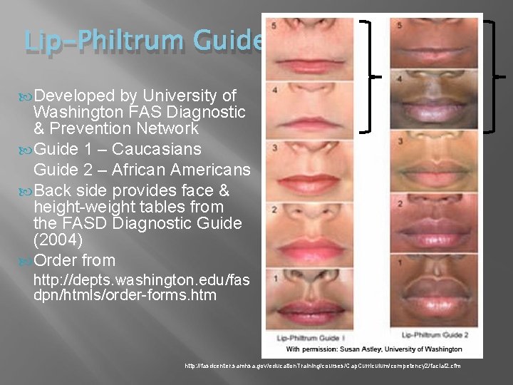 Lip-Philtrum Guide Developed by University of Washington FAS Diagnostic & Prevention Network Guide 1