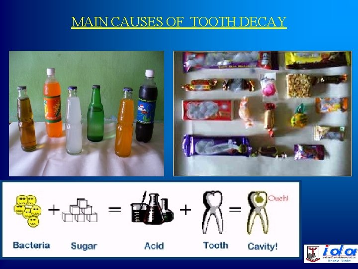 MAIN CAUSES OF TOOTH DECAY 