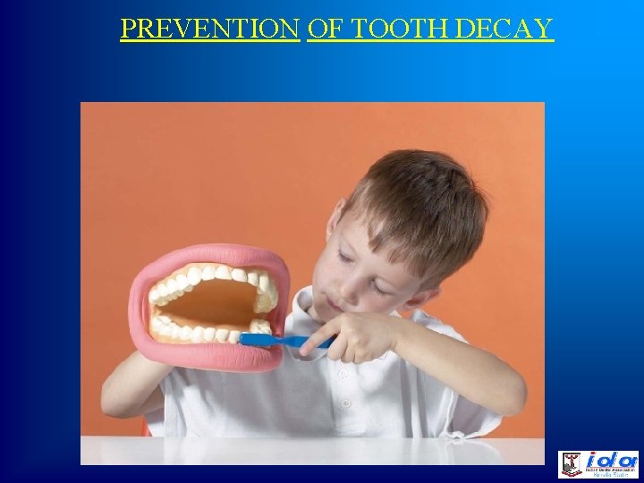 PREVENTION OF TOOTH DECAY 