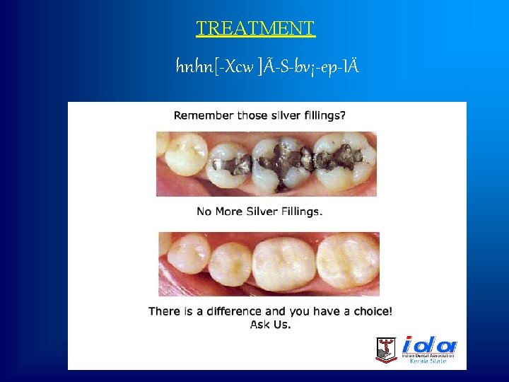 TREATMENT hnhn[ Xcw ]Ã S bv¡ ep IÄ 