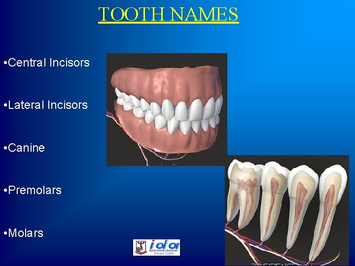 TOOTH NAMES • Central Incisors • Lateral Incisors • Canine • Premolars • Molars