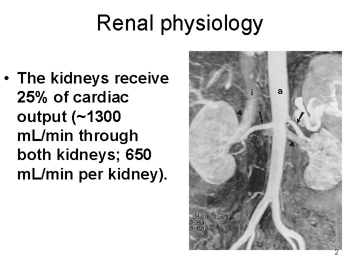 Renal physiology • The kidneys receive 25% of cardiac output (~1300 m. L/min through