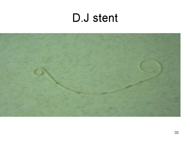 D. J stent 30 