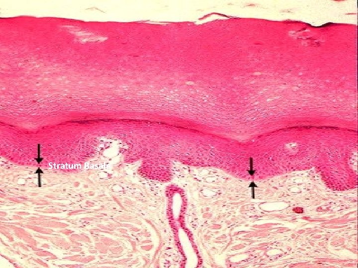 Stratum Basale 