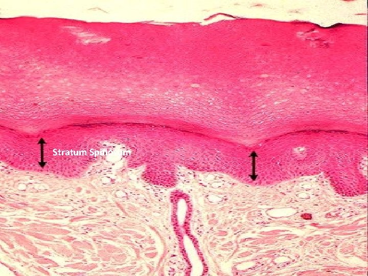 Stratum Spinosum 