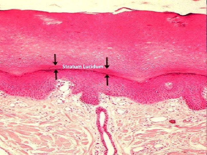 Stratum Lucidum 