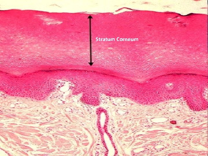 Stratum Corneum 