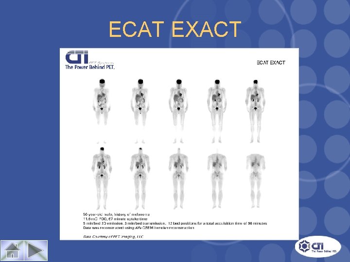 ECAT EXACT Case Study 1 