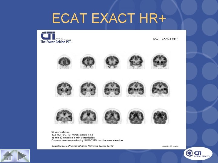 ECAT EXACT HR+ Case Study 1 