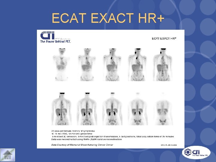 ECAT EXACT HR+ Case Study 1 