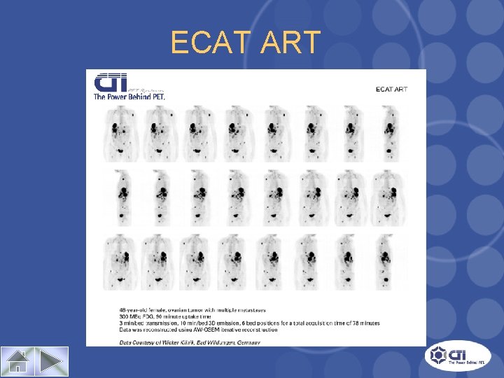 ECAT ART Case Study 1 