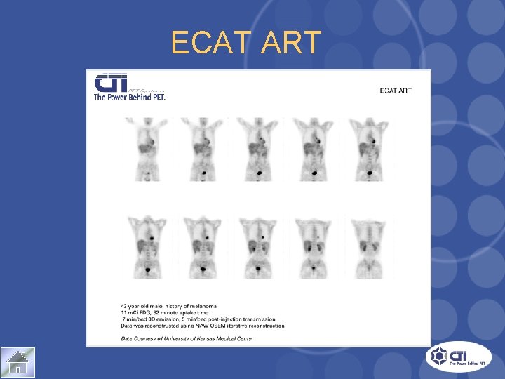 ECAT ART Case Study 1 