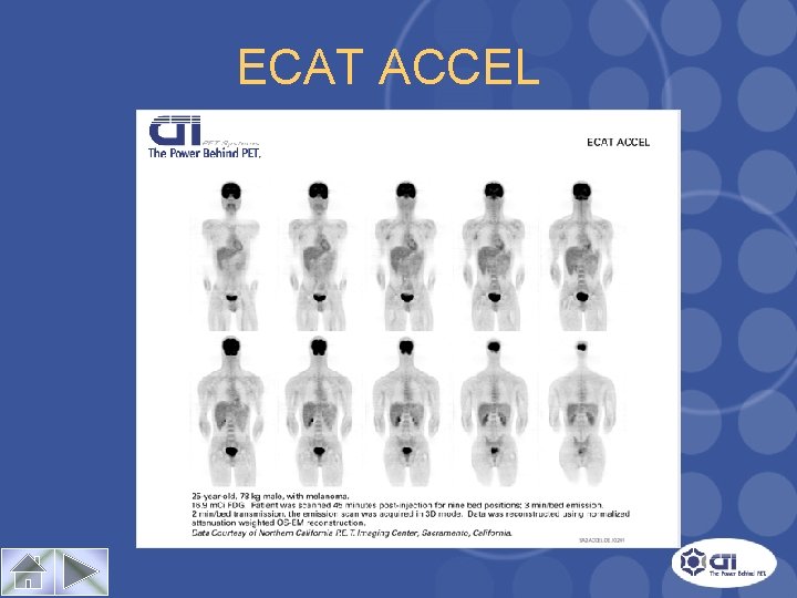 ECAT ACCEL Case Study 1 