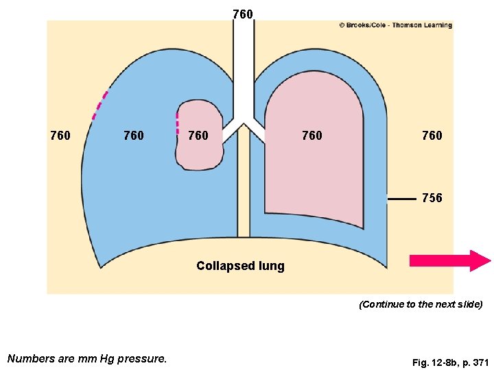 760 760 760 756 Collapsed lung (Continue to the next slide) Numbers are mm 760 760 760 756 Collapsed lung (Continue to the next slide) Numbers are mm