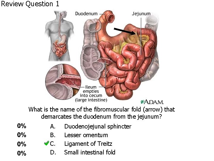 Review Question 1 What is the name of the fibromuscular fold (arrow) that demarcates