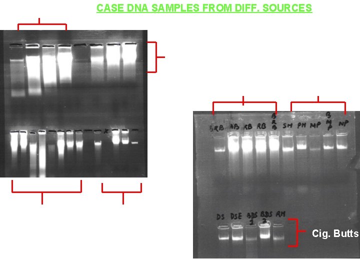 Soft Tissue CASE DNA SAMPLES FROM DIFF. SOURCES Saliva Seminal Fluid V. S Saliva