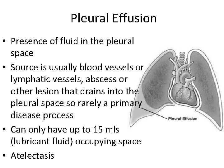 Pleural Effusion • Presence of fluid in the pleural space • Source is usually