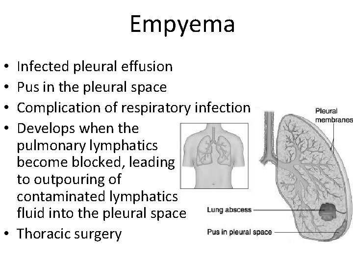 Empyema Infected pleural effusion Pus in the pleural space Complication of respiratory infection Develops