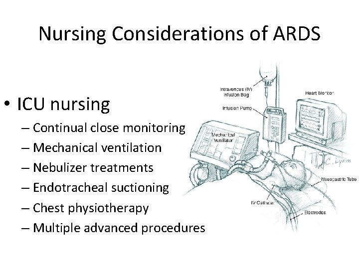 Nursing Considerations of ARDS • ICU nursing – Continual close monitoring – Mechanical ventilation