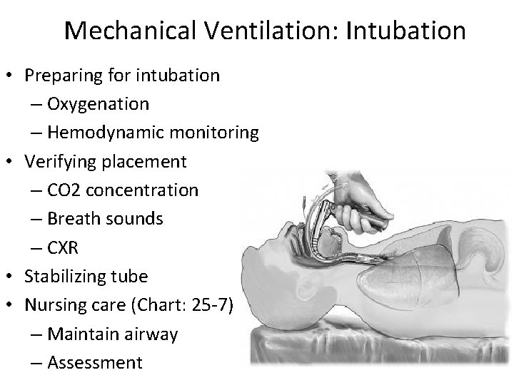 Mechanical Ventilation: Intubation • Preparing for intubation – Oxygenation – Hemodynamic monitoring • Verifying