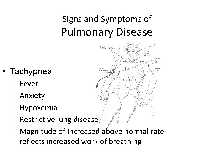 Signs and Symptoms of Pulmonary Disease • Tachypnea – Fever – Anxiety – Hypoxemia