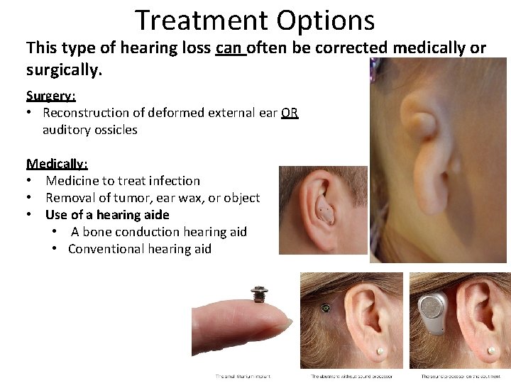 Treatment Options This type of hearing loss can often be corrected medically or surgically.