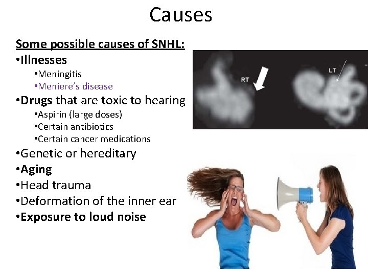 Causes Some possible causes of SNHL: • Illnesses • Meningitis • Meniere’s disease •