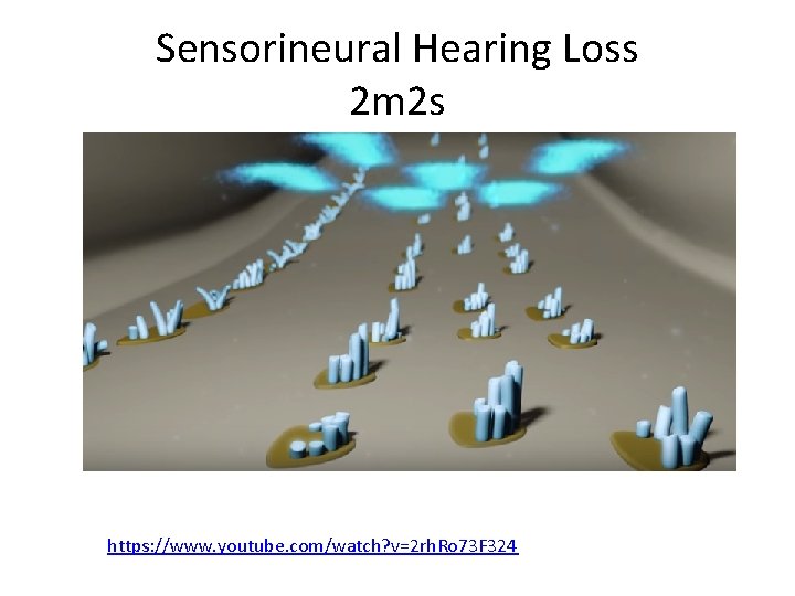 Sensorineural Hearing Loss 2 m 2 s https: //www. youtube. com/watch? v=2 rh. Ro