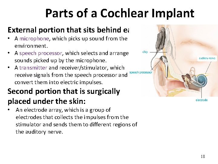 Parts of a Cochlear Implant External portion that sits behind ear: • A microphone,
